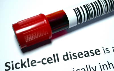 Sickle Cell Disease and Stroke in Children: What Parents Should Know